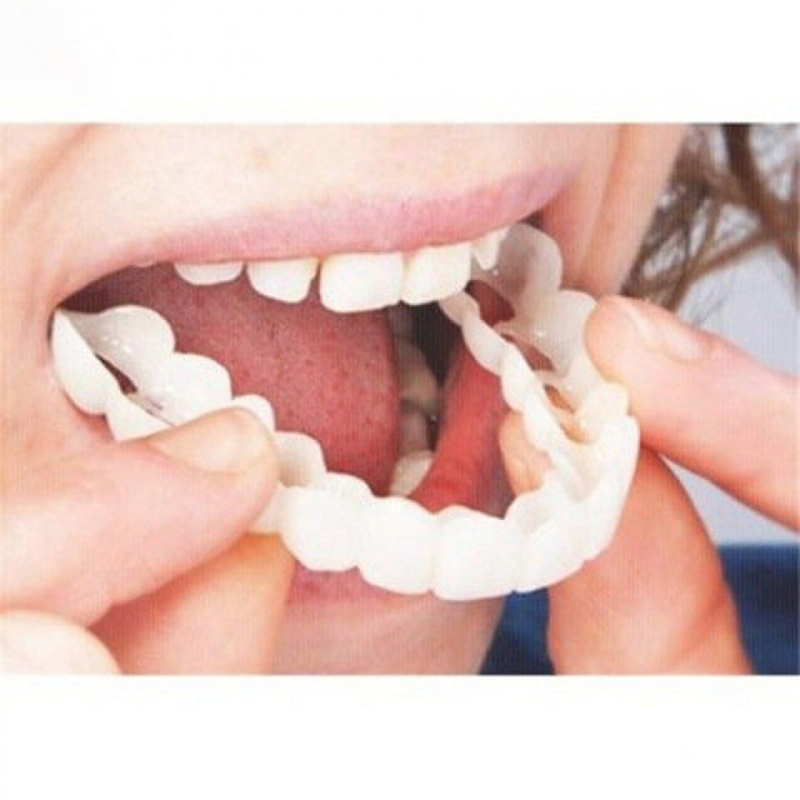 Teeth Whitening With Braces - Idealnie Dopasowane Nakładki na Zęby Wybielające