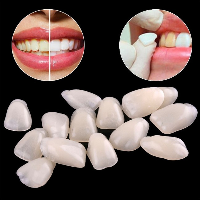 Teeth Whitening Veneers - Tymczasowe licówki dentystyczne - ultracienkie żywiczne