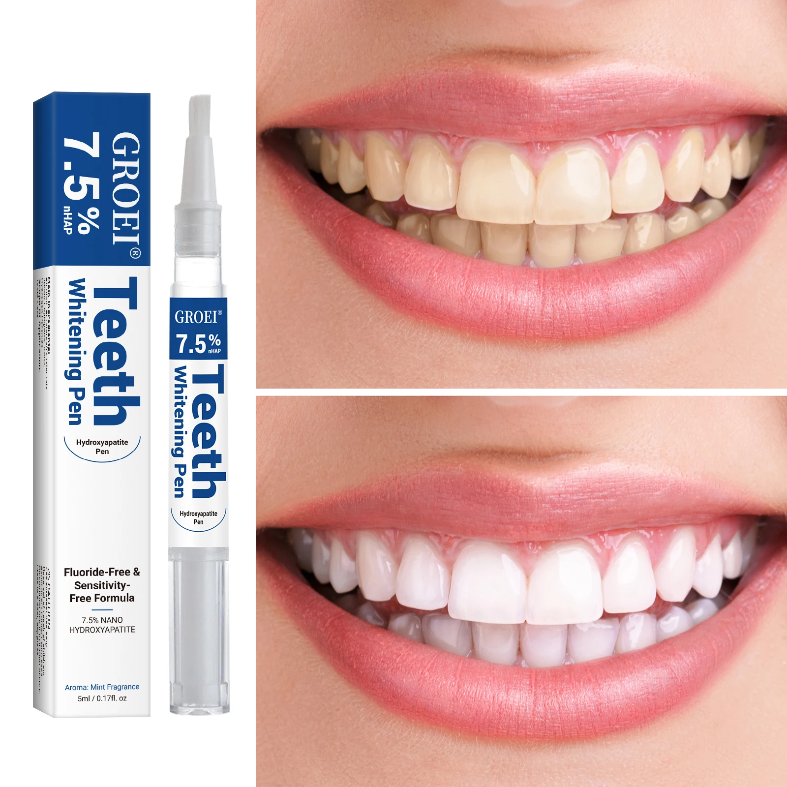 Hydroksiapatytowy długopis do  – Teeth Whitening Pen recenzja i cena