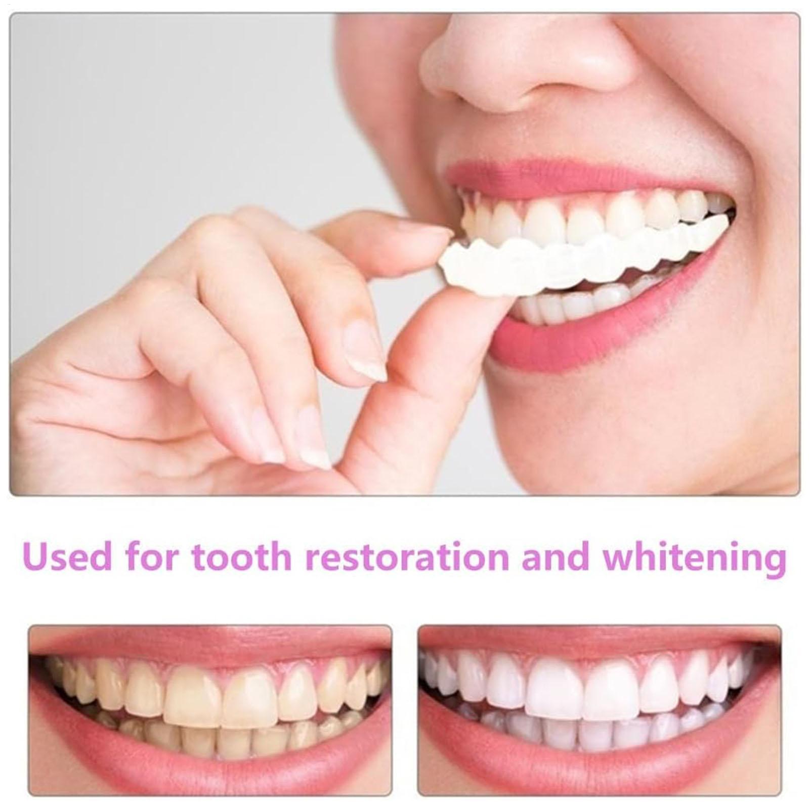 Sztuczne zęby górne i dolne, n – Teeth Whitening With Braces recenzja i cena