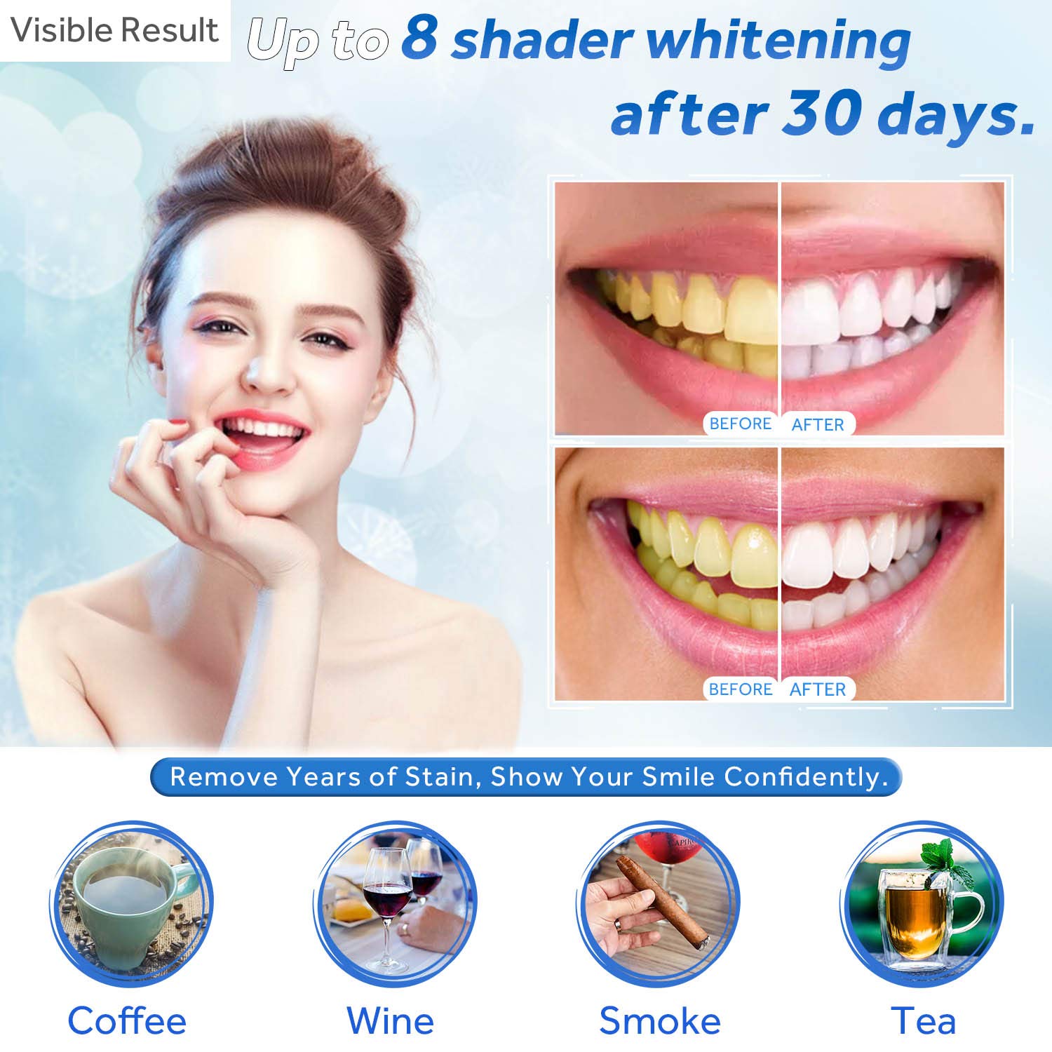 Żel do wybielania zębów w strz – Teeth Whitening Flash recenzja i cena