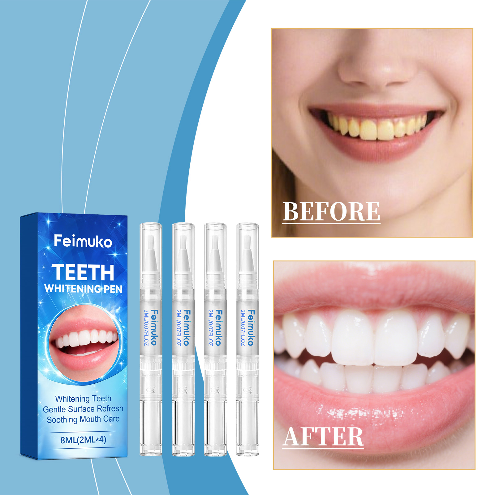 Feimuko 8ml Żelowy długopis do – Teeth Whitening Pen recenzja i cena