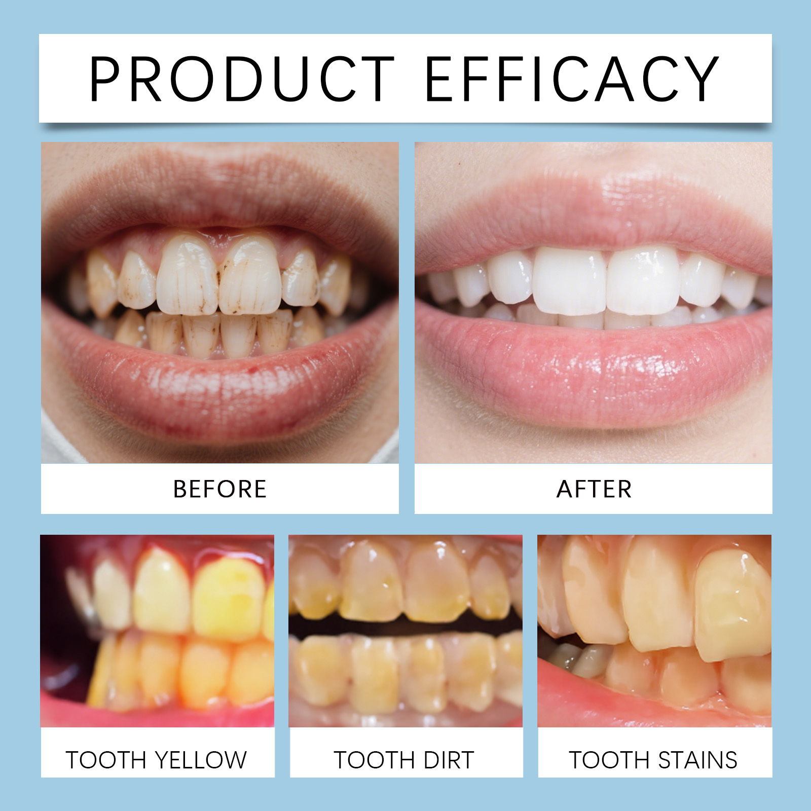 Feimuko 8ml Żelowy długopis do – Teeth Whitening Pen recenzja i cena