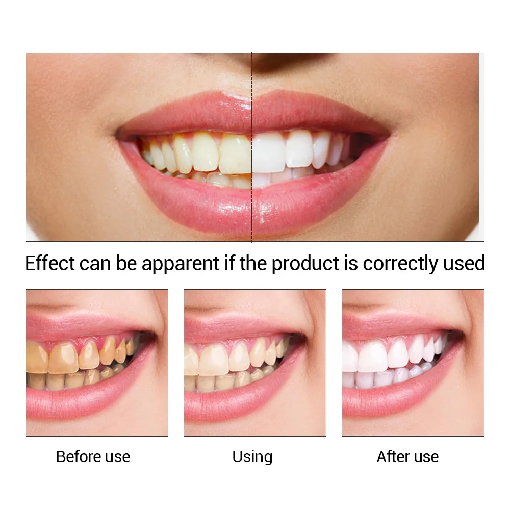 FTEENPLY esencja do wybielania – Teeth Whitening Flash recenzja i cena