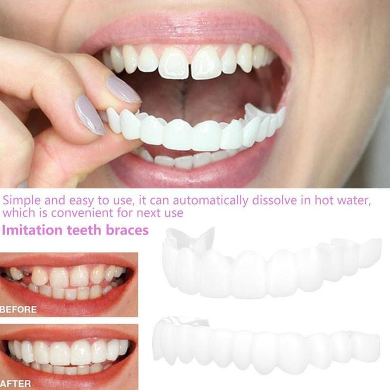Okładziny na zęby do natychmia – Teeth Whitening Veneers recenzja i cena