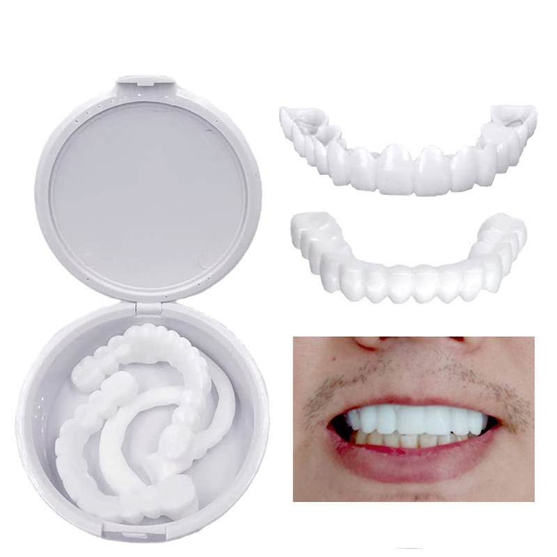 Okładziny na zęby, wybielanie, – Teeth Whitening With Braces recenzja i cena