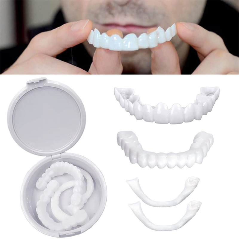 Okładziny na zęby, wybielanie, – Teeth Whitening With Braces recenzja i cena