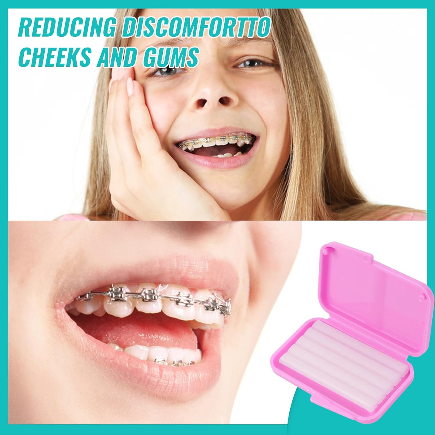 10 pudełek ortodontycznych wos – Teeth Whitening With Braces recenzja i cena