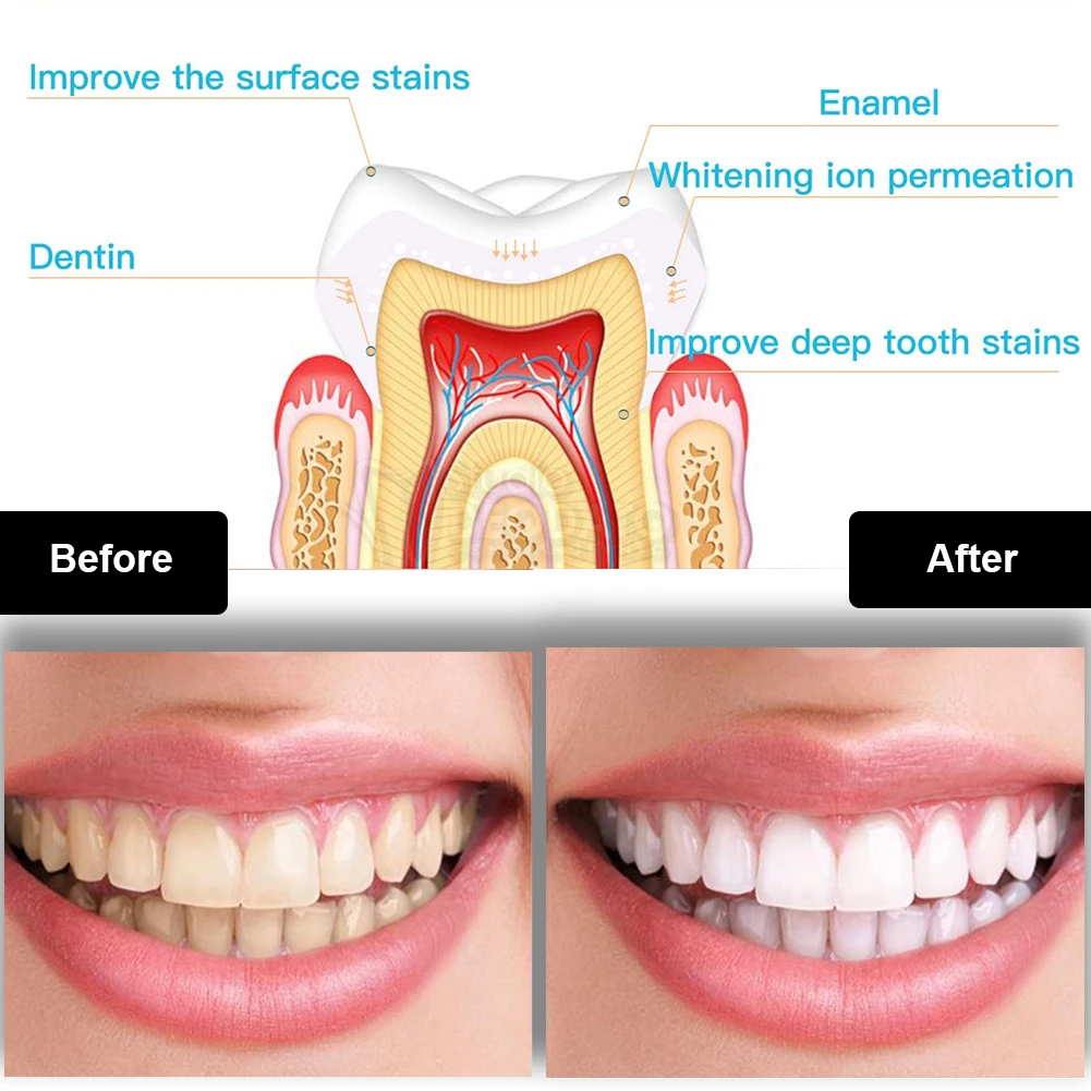 Zestaw do wybielania zębów den – Teeth Whitening Pen recenzja i cena